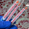 Hantavirus: SSA emite alerta epidemiológica por casos globales